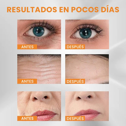 #proBEAUTYPATCH™ - REVITALIZA TU PIEL EN 7 DÍASduct_name# - TEKNOVIDA